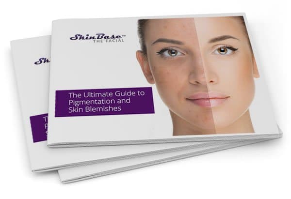 Guide to pigmentation and blemishes