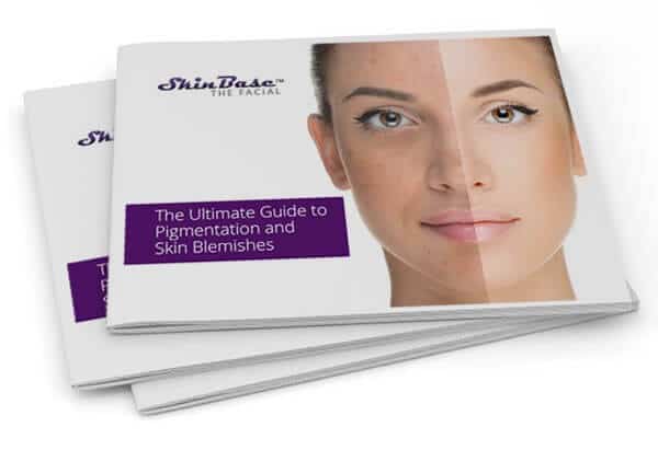 Ultimate Guide to Pigmentation and Skin Blemishes