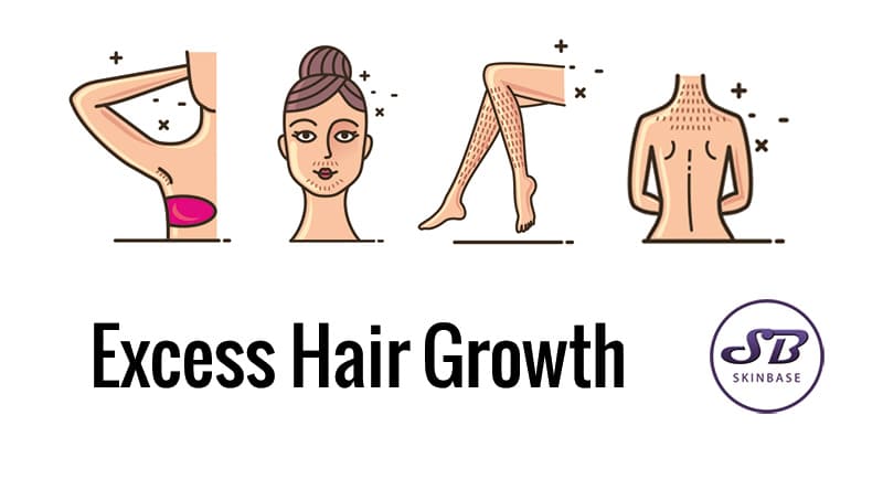 Excess Hair Growth