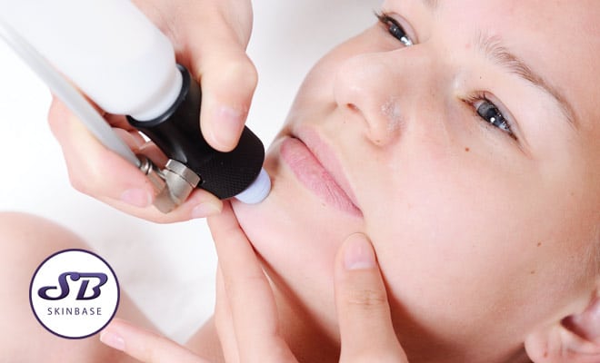 Does microdermabrasion hurt