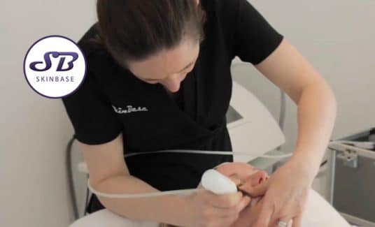 How does microdermabrasion help with spots