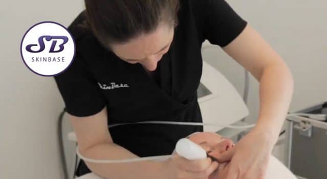 How does Microdermabrasion help with spots?
