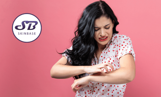 dealing with eczema