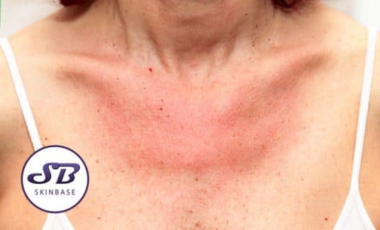 Don’t Forget About Your Neck