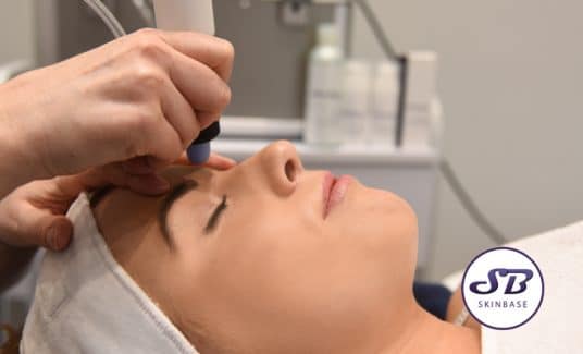 microdermabrasion