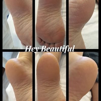 pedicure