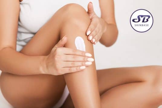 eczema