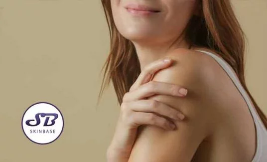 blotchy skin