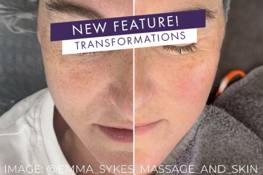 transformations 2
