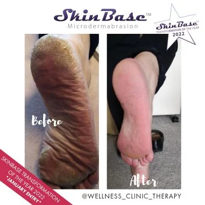 https://skinbase.co.uk/wp-content/uploads/2022/03/transformation-ba-jan-wellness-1-400x400.jpg.webp