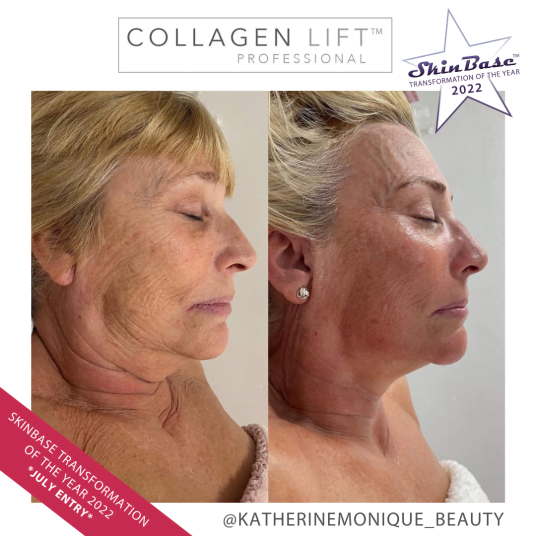 COLLAGEN LIFT KATHERINEMONIQUEBEAUTY