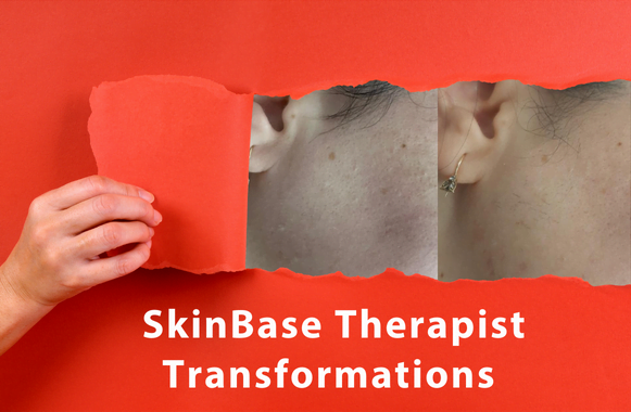 SkinBase Therapists
