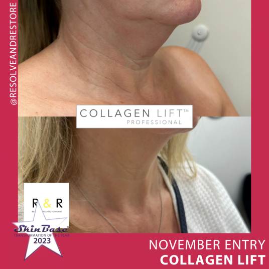November collagen lift entries: Resolve and Restore