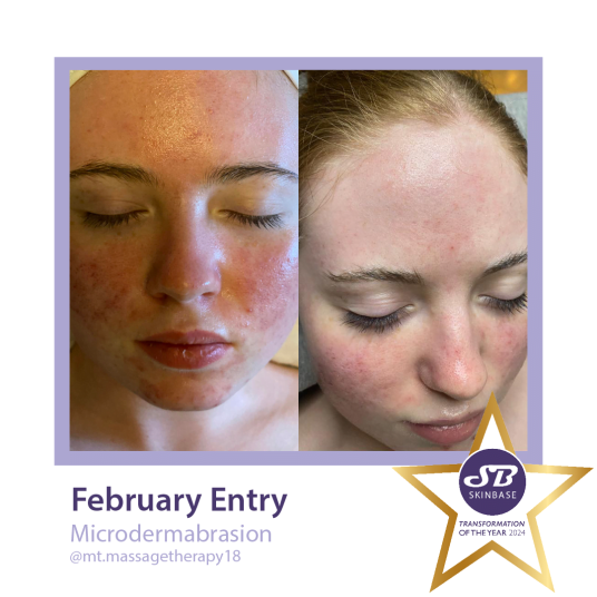 confidence boosting SkinBase treatments - mt massage therapy