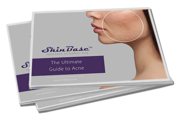 acne guide