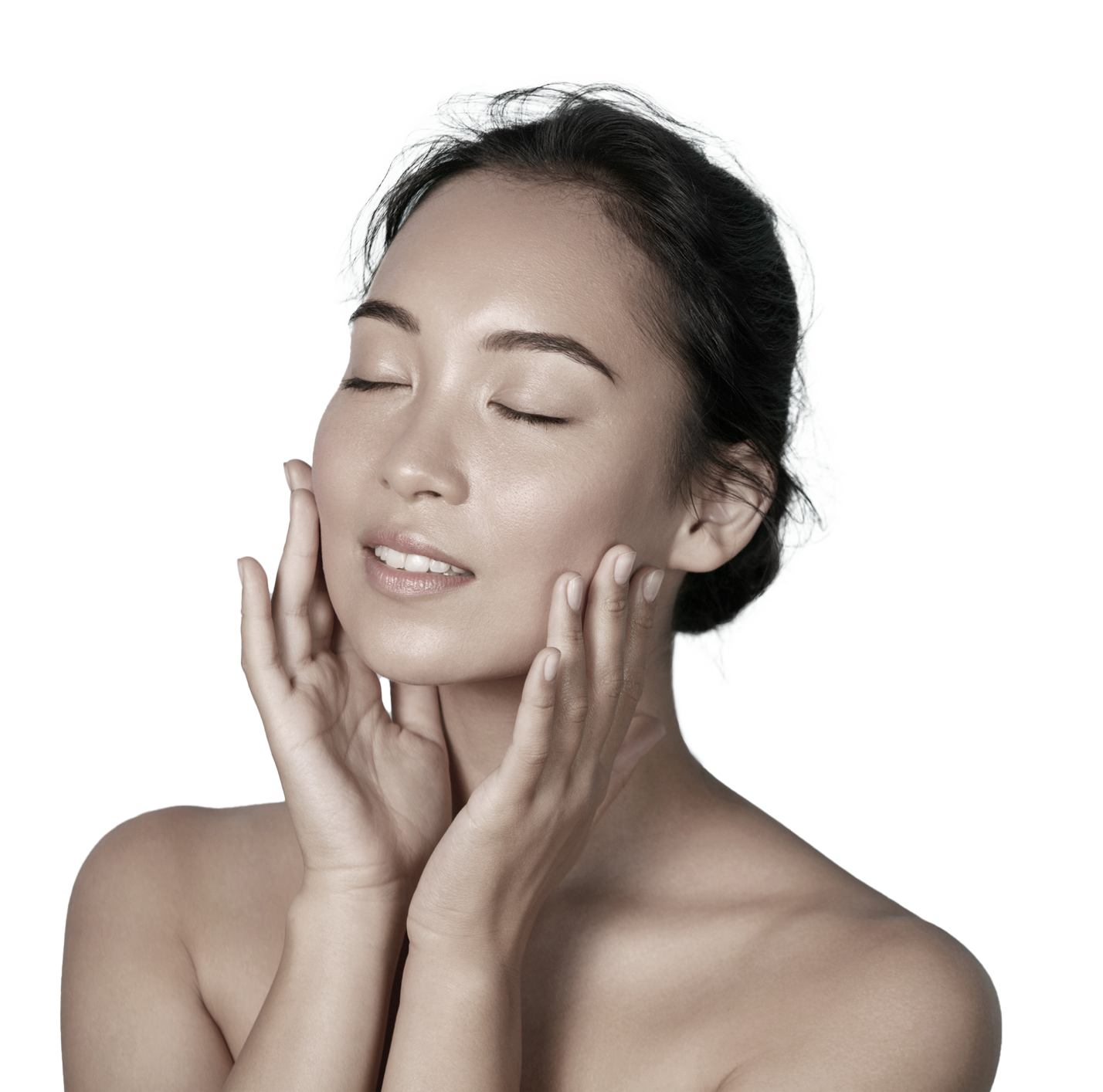 rosacea