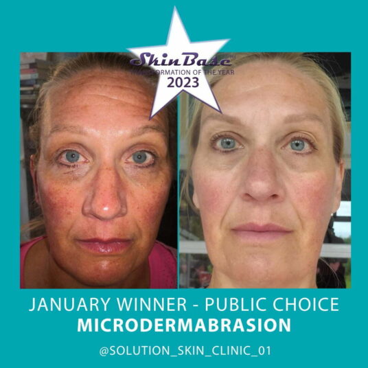 January Transformation Winners