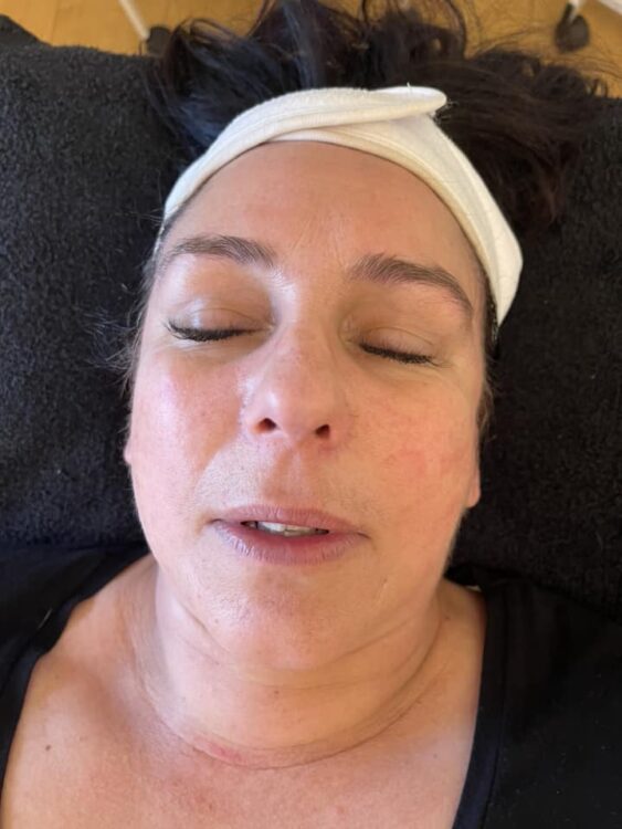 Collagen Lift: Transform Your Skin Without Surgery