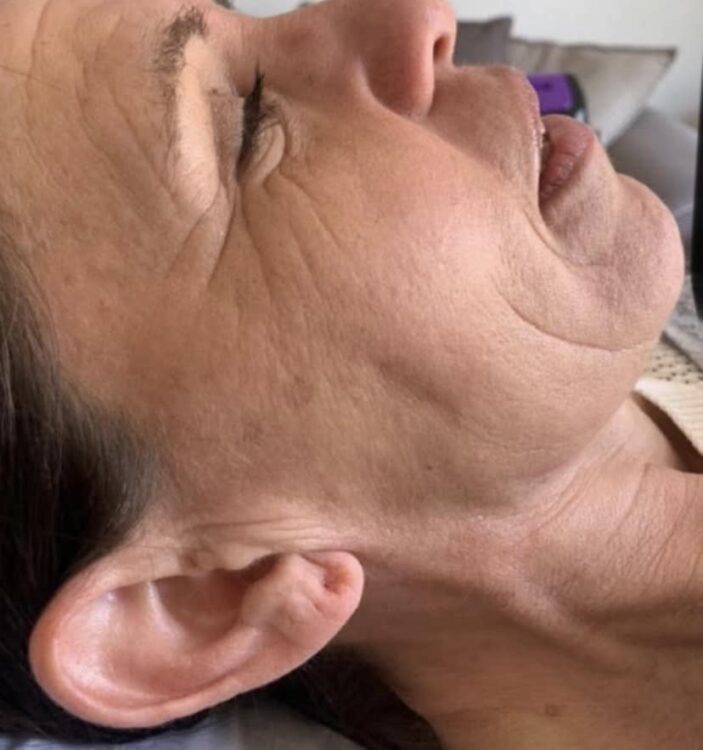 祐*様 2箱分　イリュン　collagen　skinbase Collagen Lift: Transform Your Skin Without Surgery