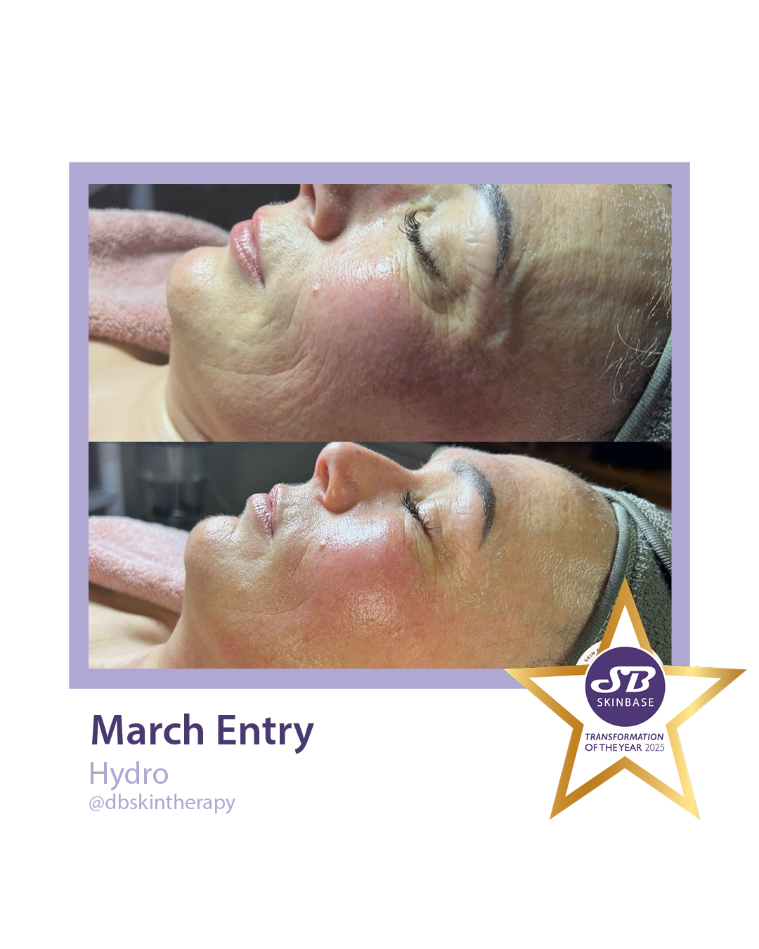 march entries db skin therapy
