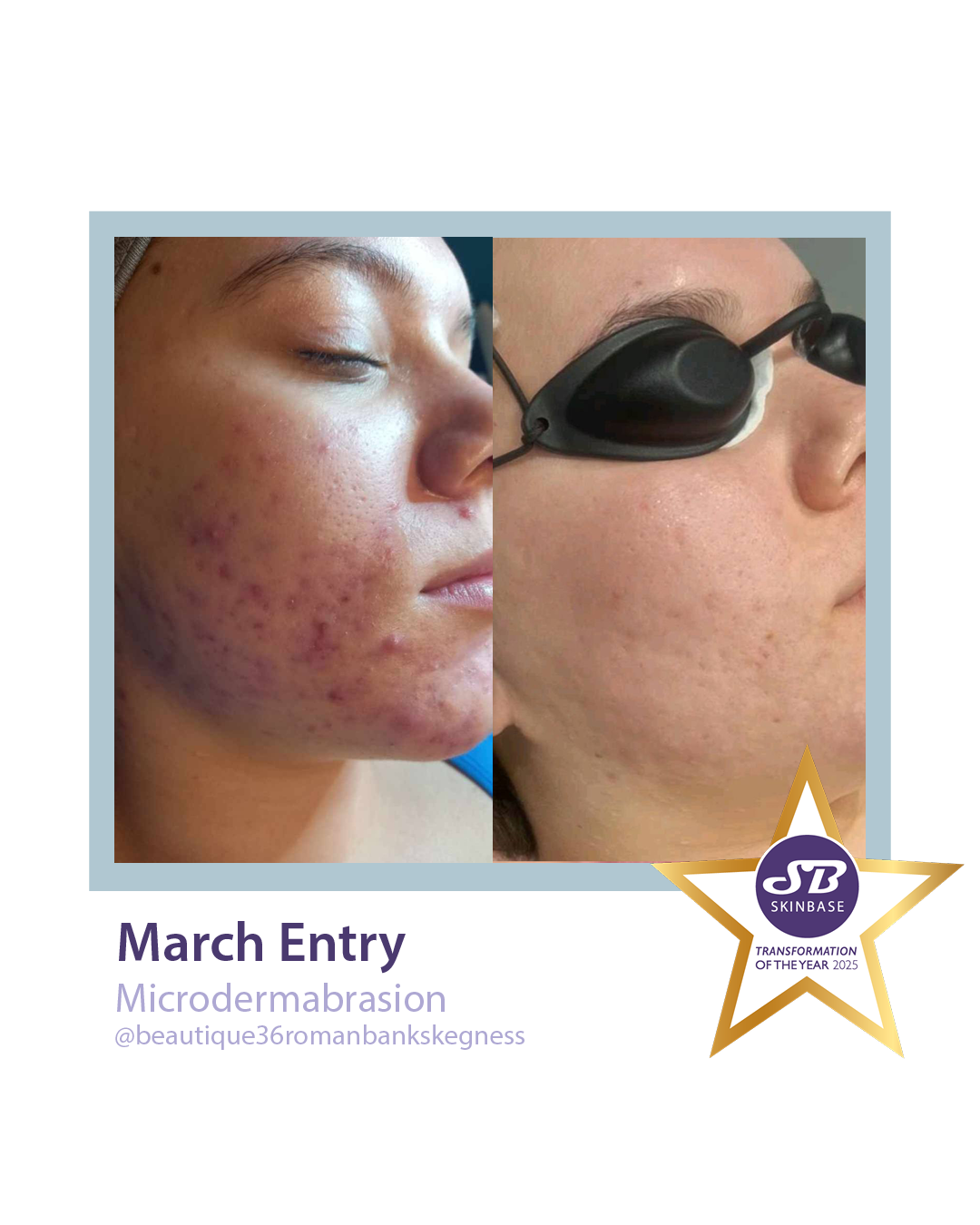who will be our march finalists?