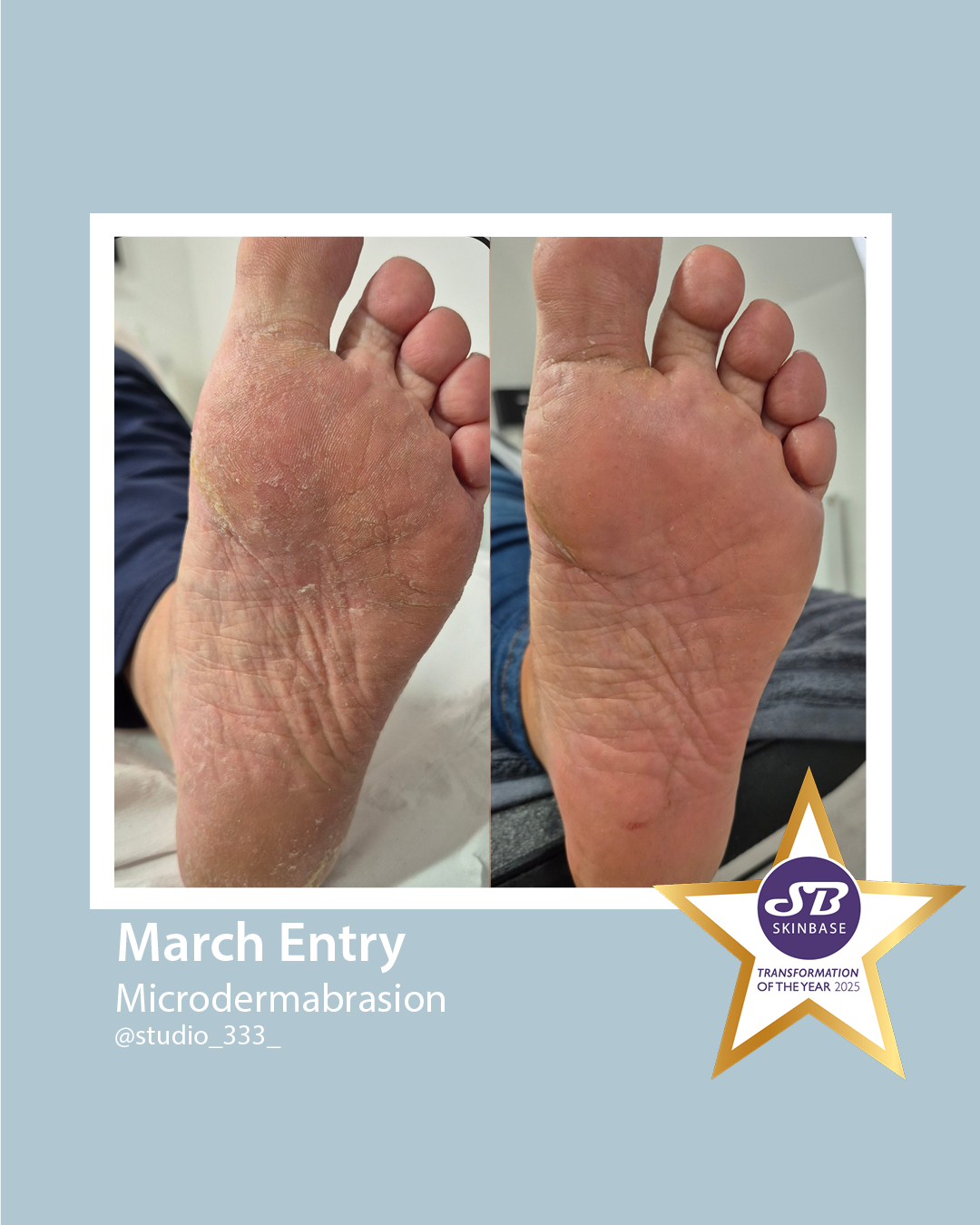 who will be our march finalists?