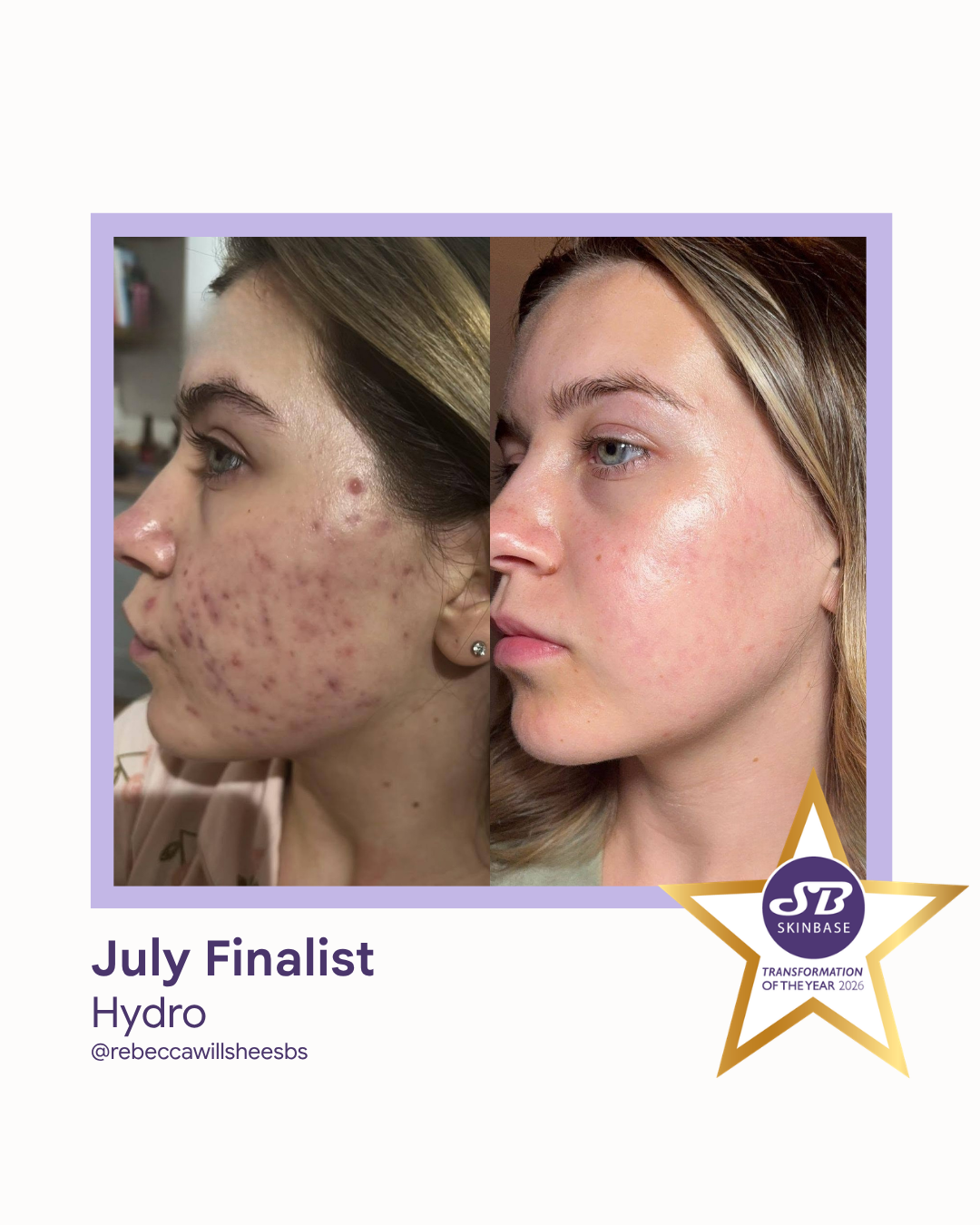July 2026 Rebecca Willshee Skin and Beauty Specialist Hydro