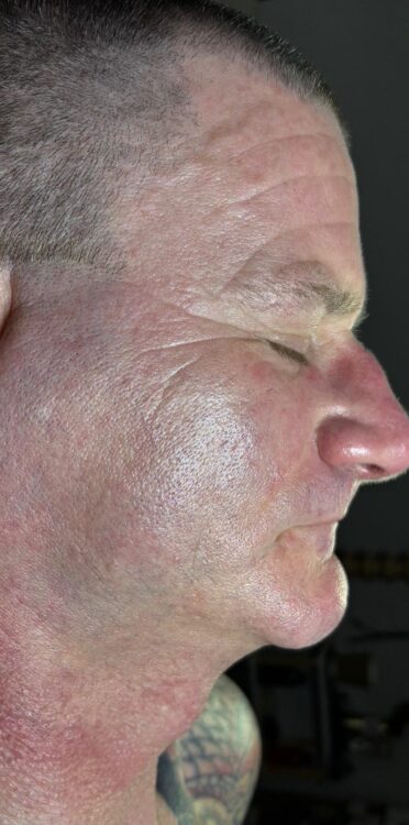 April 2026 DB Skin Therapy Microdermabrasion Facial for Ageing Skin After