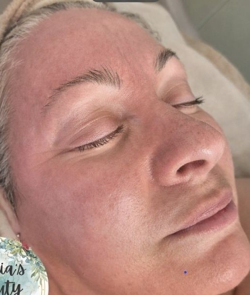 April 2026 Maria's Beauty Spot Microdermabrasion Hydro Facial for Ageing Skin After