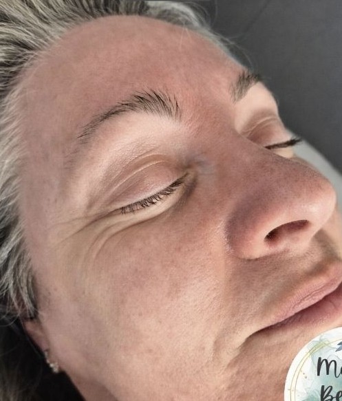 April 2026 Maria's Beauty Spot Microdermabrasion Hydro Facial for Ageing Skin Before