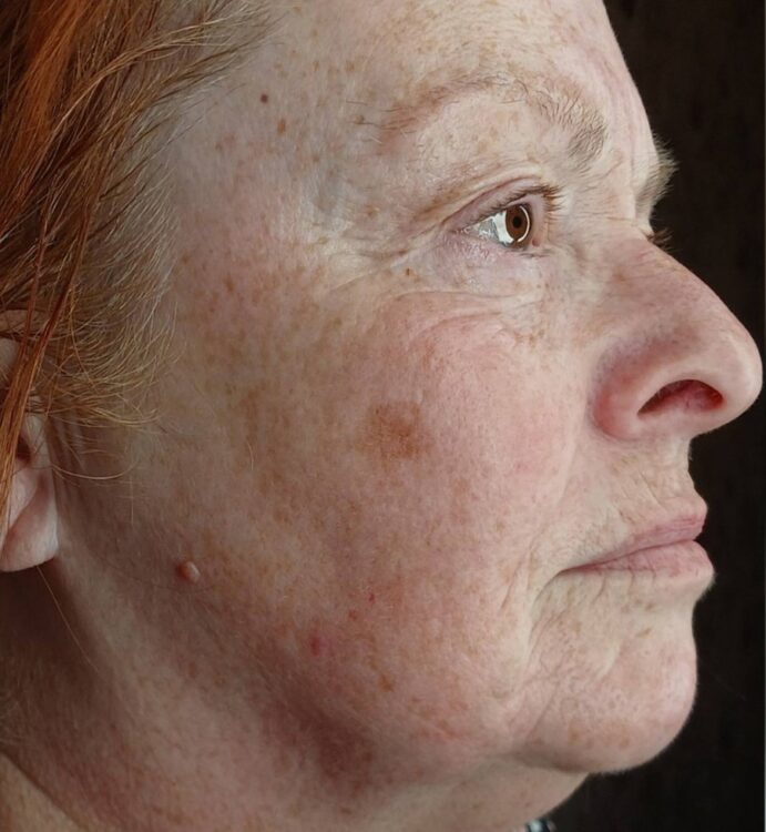 April 2026 Mel's Beauty Collagen Lift Facial for Ageing Skin After