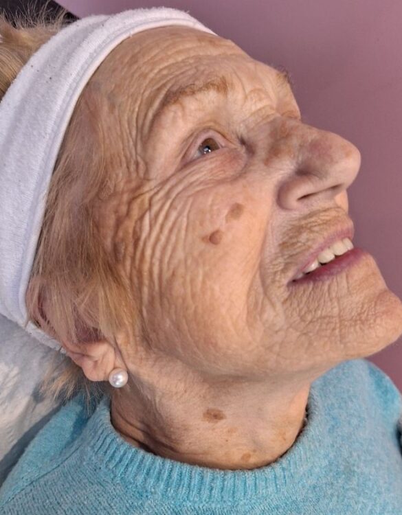 April 2026 Pink Beauty Collagen Lift Facial for Ageing Skin Before