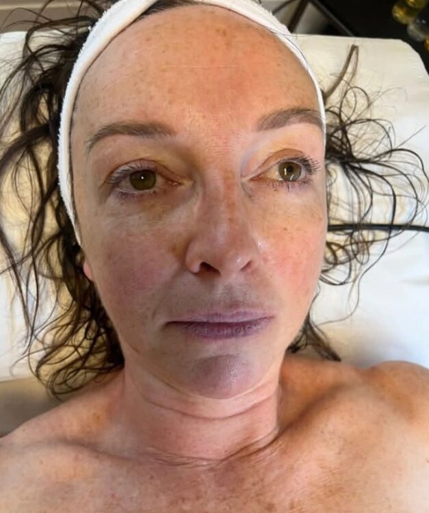 August 2026 Bodyology Collagen Lift Facial for Ageing Skin Before