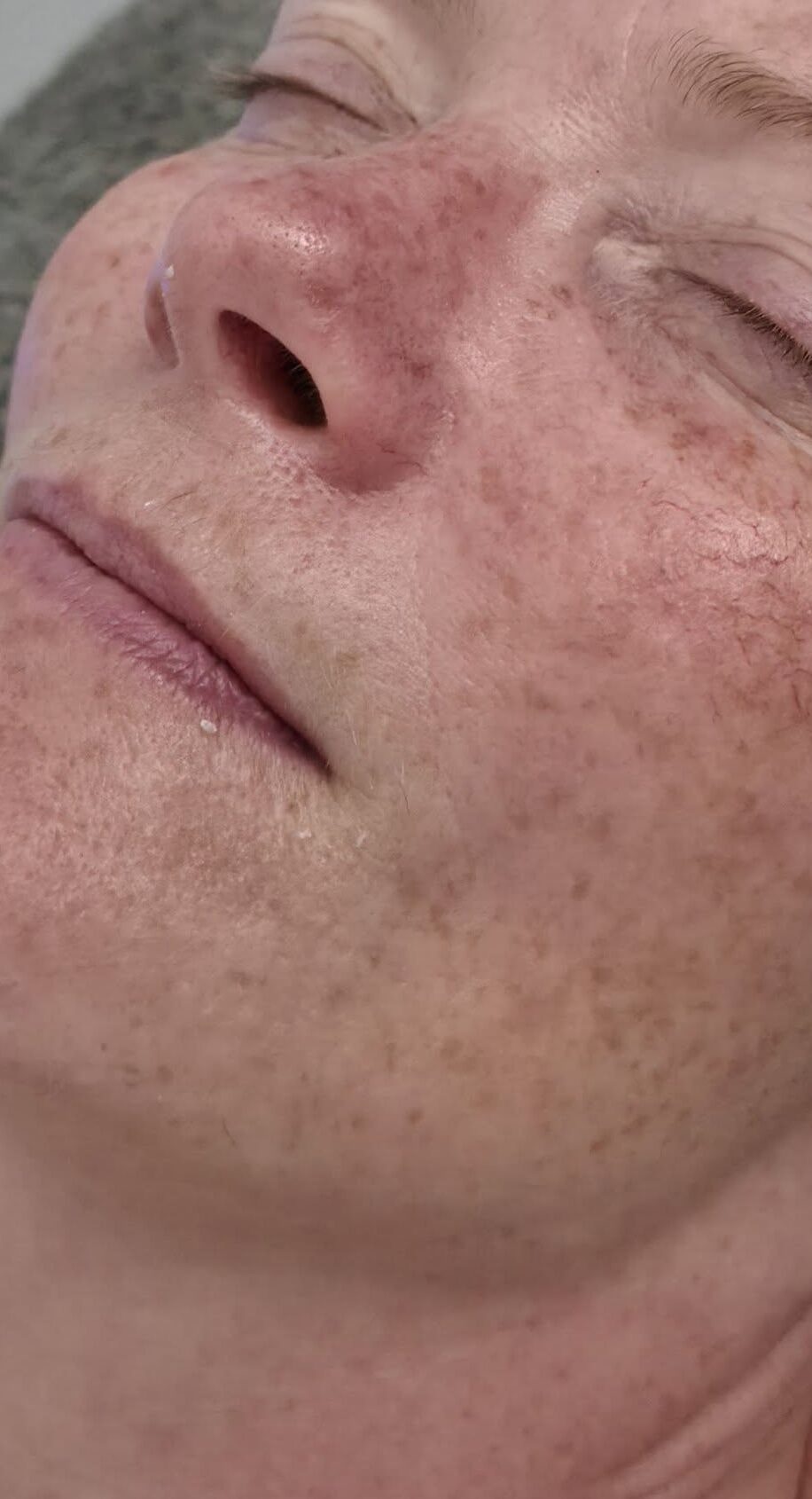 June 2026 Beauty by Rebecca Alice Microdermabrasion Facial for Ageing Skin After
