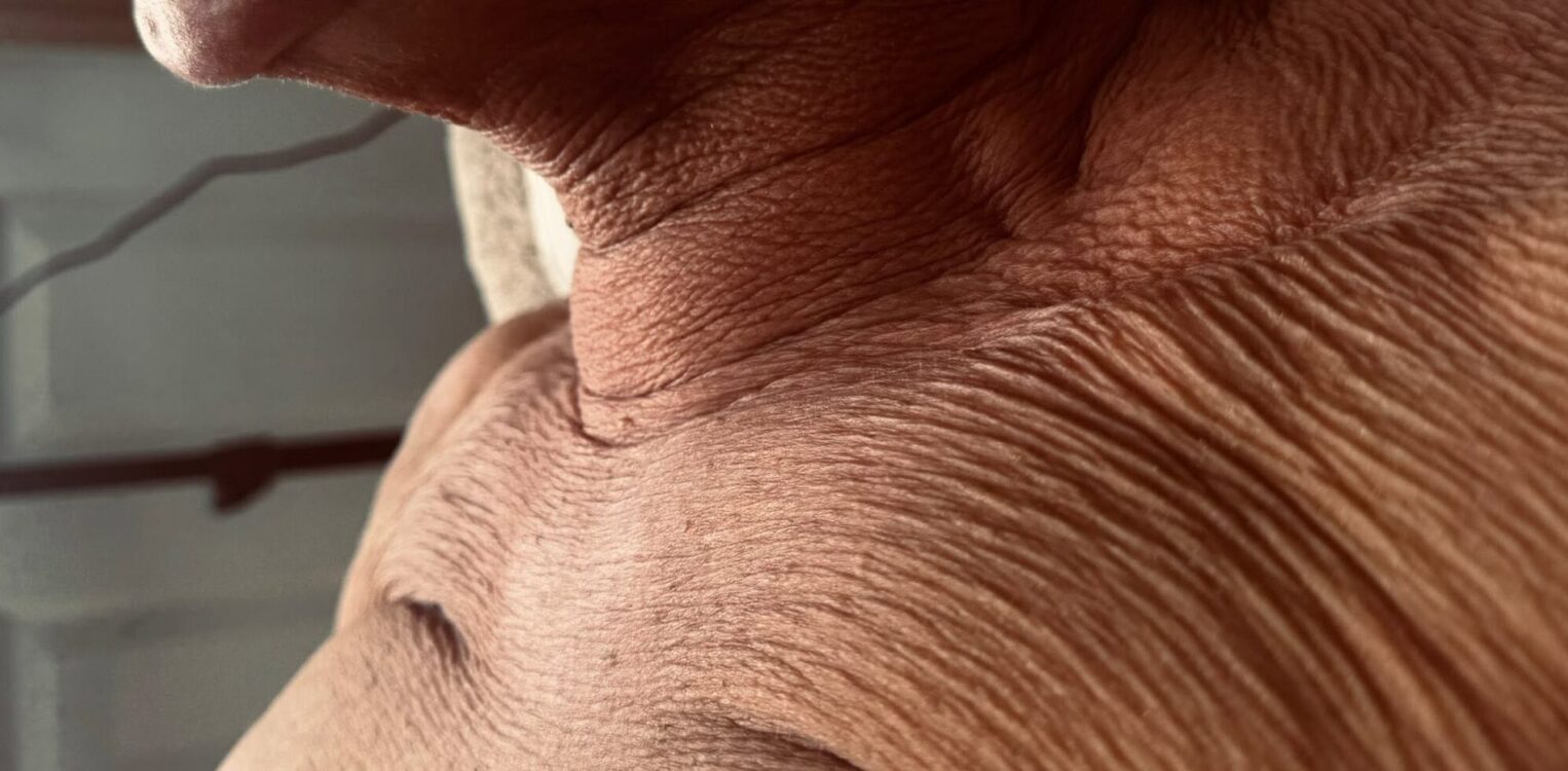 June 2026 The Body Bar Collagen Lift Facial for Ageing Skin Before