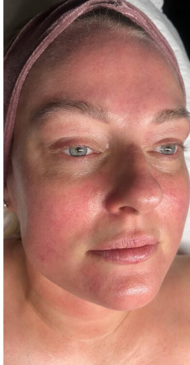 May 2026 Bodyology Microdermabrasion Facial for Uneven Skin After