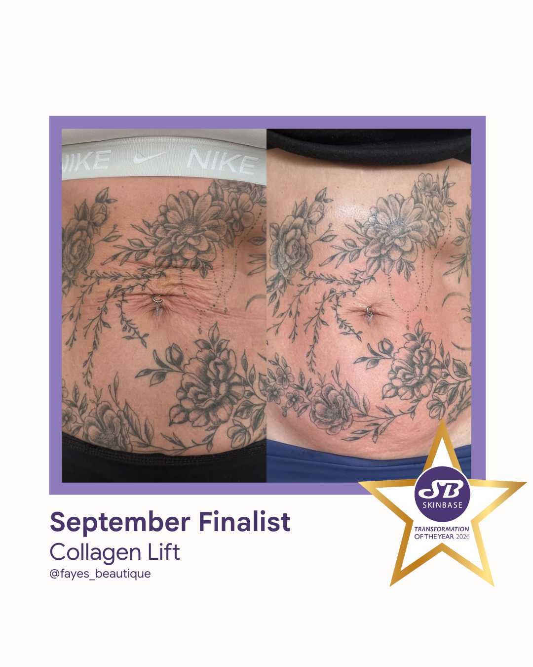 84 September Finalist 2026 Faye's Beautique Collagen Lift